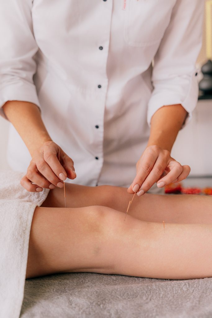 Acupuncture in Toowoomba.